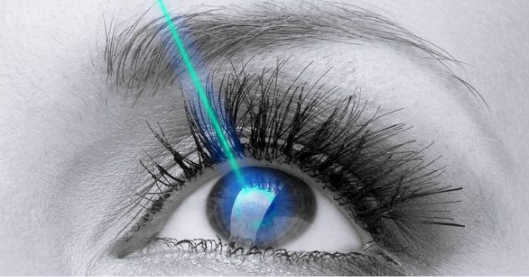 جراحی عيوب انکساری قرنيه جراحی عيوب انکساری قرنيه