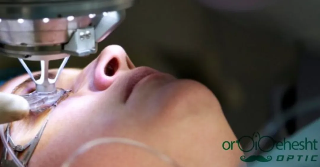 اشنایی با عمل لیزر اشنایی با عمل لیزر