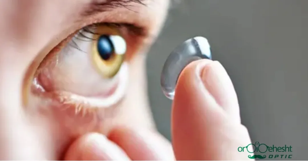 لنزهای تماسی