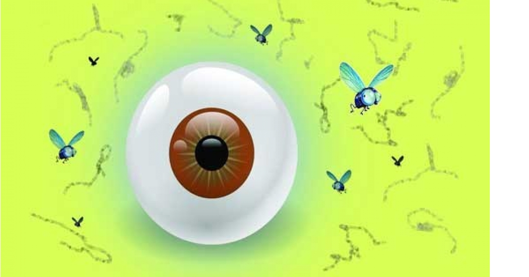 درمان خانگی مگس پران چشم