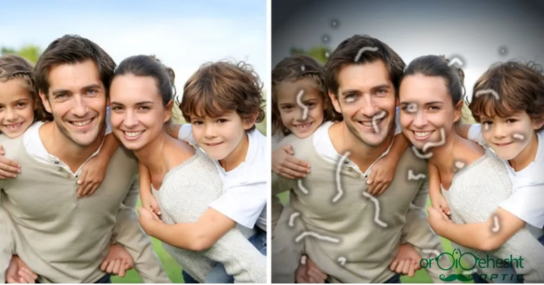 مگس پران و جرقه (Floaters and Flashes)