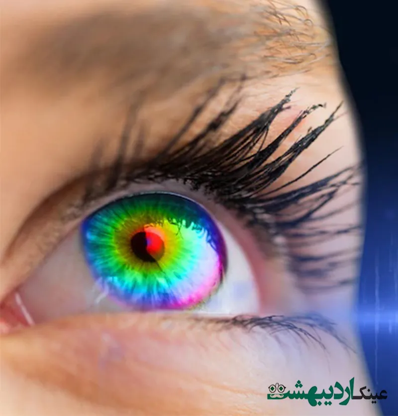 لنز های تماسی رنگی و طبی مارشال