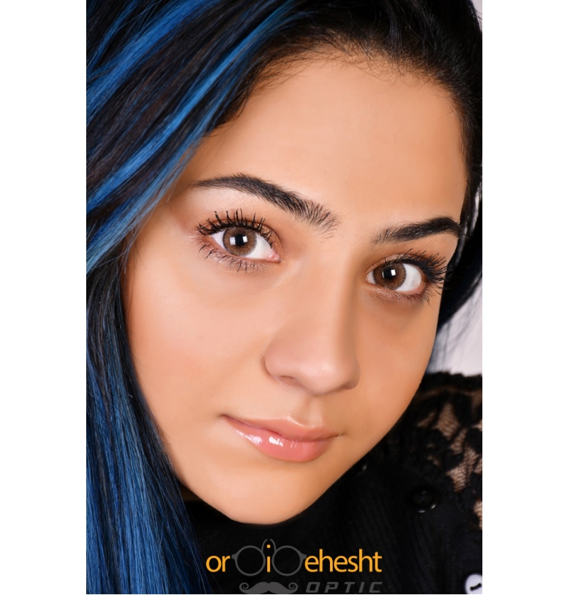 لنز چشم مجیک ویژن