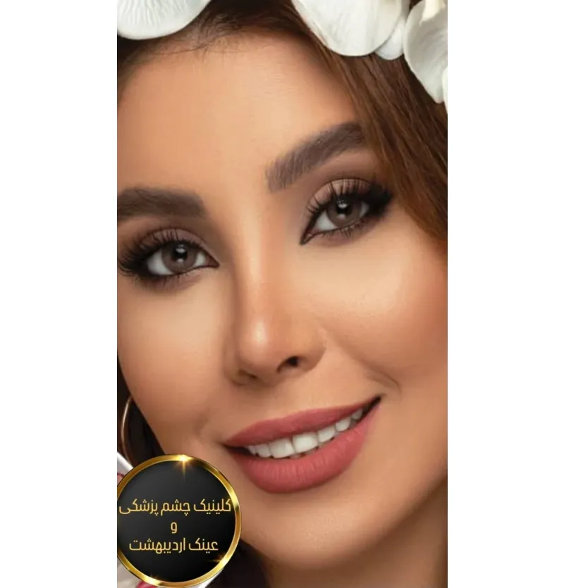 ✔️لنز چشم برند كريستال كالراستراليا کد peanut brown